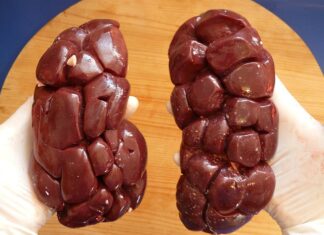 Czy nerka liczy się jako bagaż podręczny Wizzair?